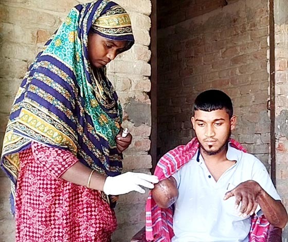 ছাত্র আন্দোলনে এক হাত হারা রানা: খবর রাখে না কেউ
