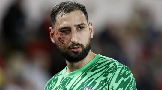 মুখে বুটের আঘাতে মারাত্মক ভাবে আহত দোন্নারুম্মা