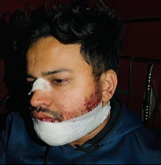 কটিয়াদীতে ছাত্র হত্যা চেষ্টায় গ্রেপ্তার ১