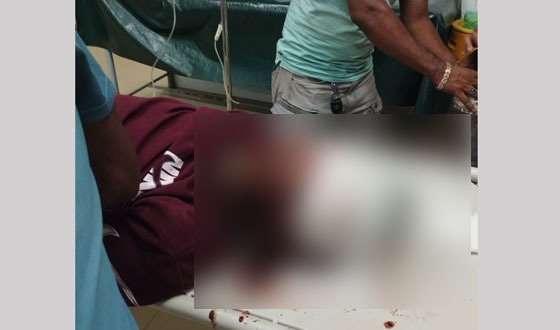 মতলবে মোটর সাইকেল দুর্ঘটনায় নিহত ১