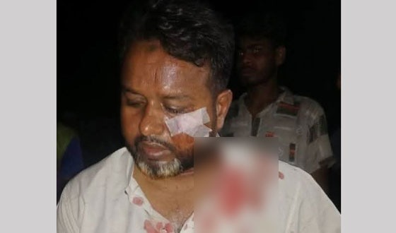 শৈলকুপায় অতর্কিত হামলায় স্বেচ্ছাসেবক দলের আবু খায়ের খাঁন আহত