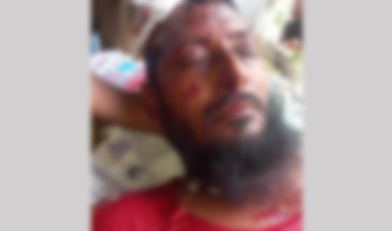 দৌলতপুরে জমি নিয়ে বিরোধের জেরে হামলা, হত্যা চেষ্টায় যখম ১