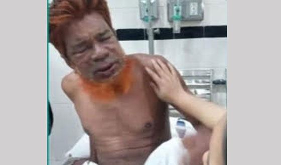 মতলব উত্তরে ভিমরুলের কামড়ে হতাহত ৪