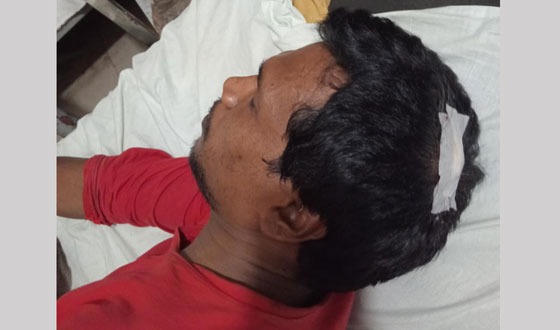 সরিষাবাড়ীতে সাংবাদিকের ওপর হামলা, পুলিশ উদ্ধার করে হাসপাতালে প্রেরণ