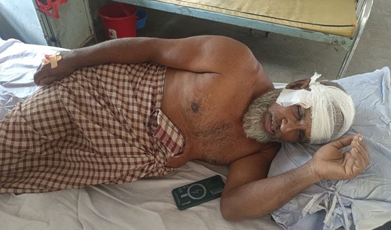 দেবহাটায় তুচ্ছ ঘটনায় মারপিটে জখম, থানায় অভিযোগ দায়ের