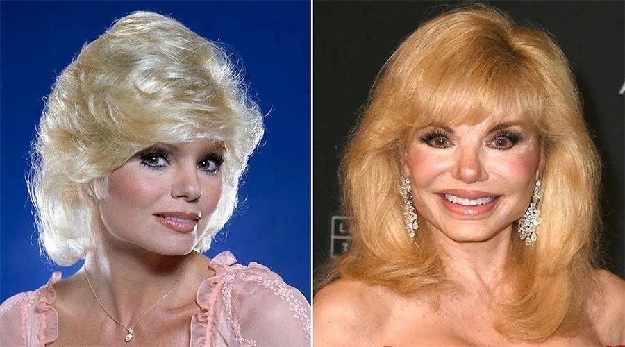 চলে গেলেন লনি অ্যান্ডারসন