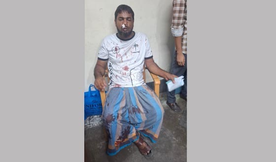 কলেজ চত্বরে ব্যবসায়ীর নাক ফাটিয়ে দেয়ার অভিযোগ শিক্ষকদের বিরুদ্ধে