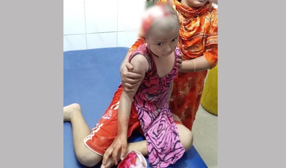 গজারিয়ায় ব্যাটারী চালিত অটো চাপায় গুরুতর আহত ১