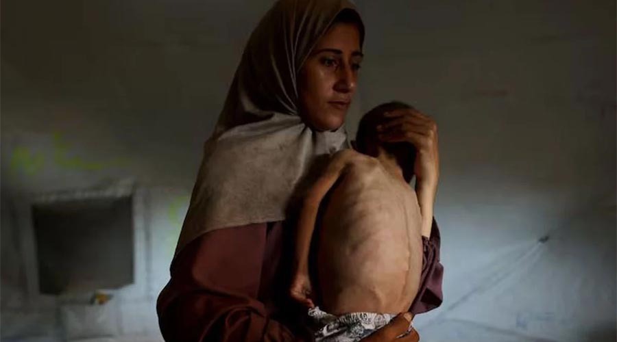 গাজায় অনাহার ও অপুষ্টিতে মৃত্যুর সংখ্যা বেড়ে ২১২