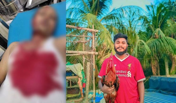 চট্টগ্রামে আ. লীগের মিছিল, অভিযানে যাওয়া পুলিশ সদস্যকে কুপিয়ে আহত