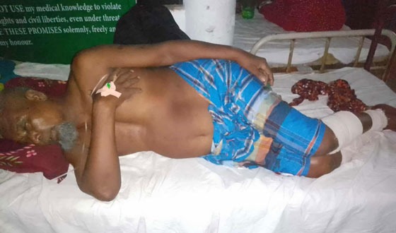 শৈলকুপায় ব্যবসায়ীর পায়ের রগ কর্তন