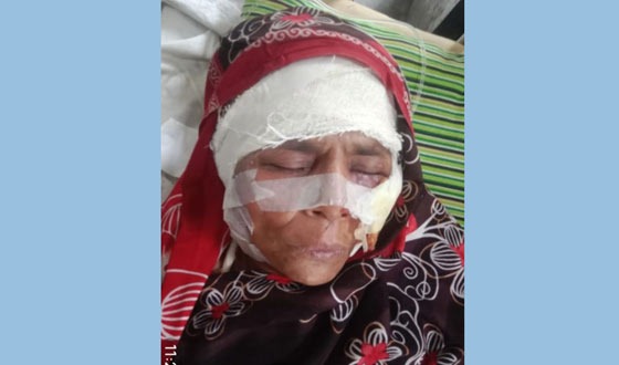 বাবুগঞ্জে পুত্রবধূর বিরুদ্ধে শাশুড়িকে হত্যার চেষ্টার অভিযোগ