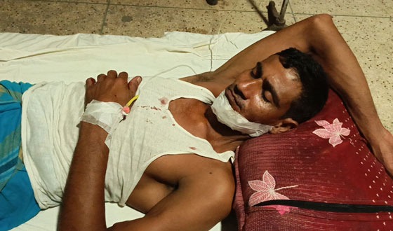 জমিজমার বিরোধে বড় ভাই কোপালো ছোট ভাইকে