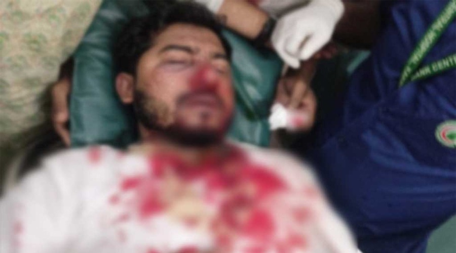 জাপা কার্যালয়ের সামনে দফায় দফায় সংঘর্ষ, রক্তাক্ত ভিপি নুর