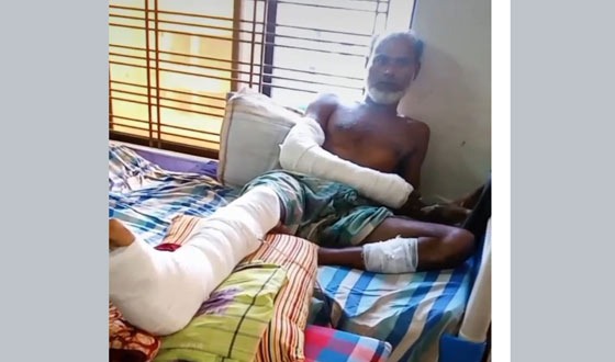 রাজারহাটে বড় ভাইয়ের হাত-পা ভেঙ্গে দিলো ছোট ভাইয়েরা