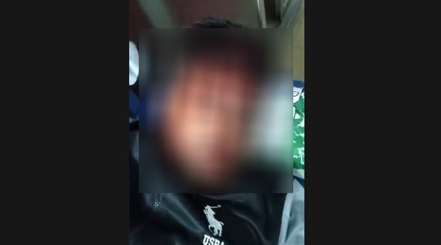 উত্তরায় জুলাই রেভেলস সংগঠনের ২ সদস্যকে কুপিয়ে মুমূর্ষু