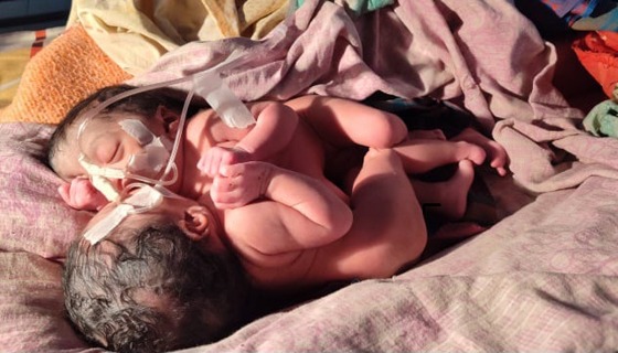 ধামইরহাটে আলোচিত জমজ শিশুদের মৃত্যু