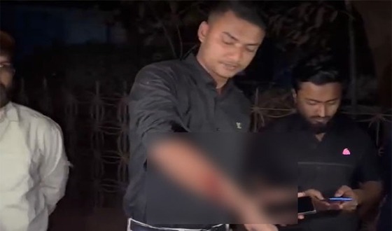 গাজীপুরে কর্মসূচি শেষে এক কর্মী গুলিবৃদ্ধ