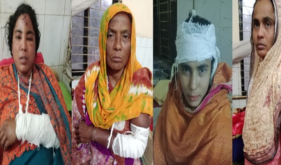 ধান রোপন করতে গিয়ে হামলার শিকার ৫ নারী: থানায় অভিযোগ
