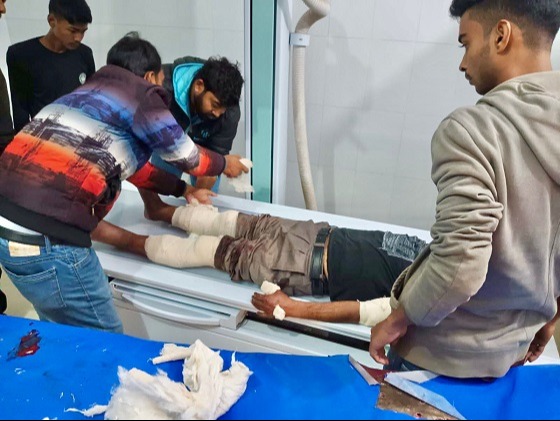 সাবেক প্রতিমন্ত্রীর চাচাকে পিটিয়েছেন বিএনপির নেতাকর্মীরা