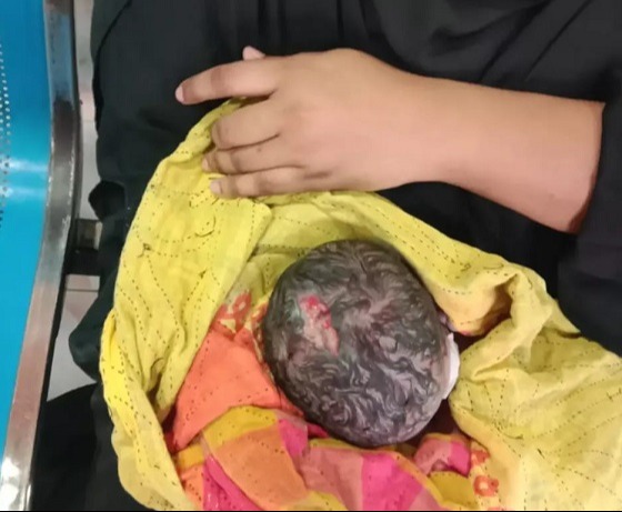 হাসপাতালের বিরুদ্ধে নবজাত‌কের মাথা কাটার অ‌ভি‌যোগ!