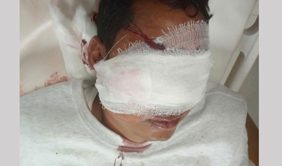 কাউখালীতে সেনা সদস্যকে কুপিয়ে আহত