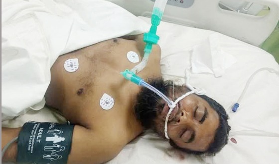 টঙ্গীর বিশ্ব এস্তেমায় আহত ফুলবাড়ীর সাদপন্থি সুমন মারা গেল