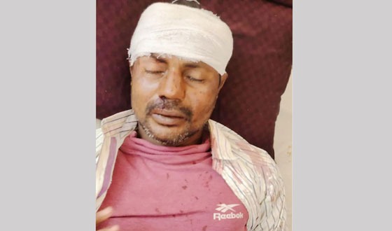 মান্দায় বিজিবি সদস্যের বিরুদ্ধে হত্যাচেষ্টার মামলা