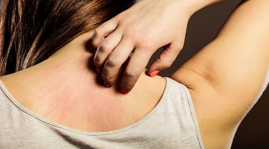 ভিটামিন ডি কমে গেলে শরীরে যেসব সমস্যা দেখা দেয়