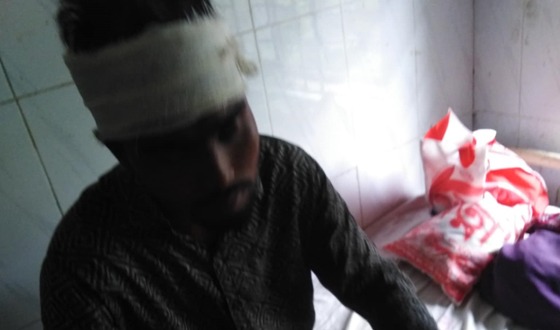 সরকারি খাল উন্মুক্তকারী শ্রমিকের উপর দূর্বৃত্তদের হামলা