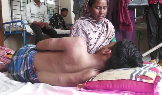 দুই টুকরা কমলা খাওয়ায় এতিম শিক্ষার্থীকে পিটিয়ে জখম করলো শিক্ষক