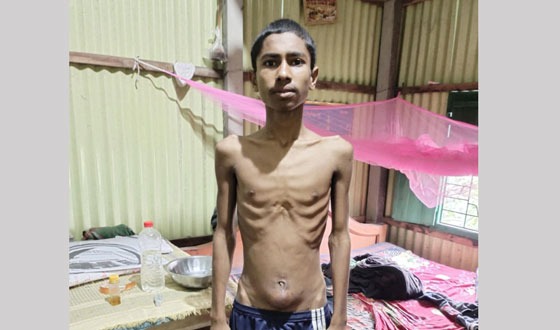 ভূঞাপুরে মরণঘাতী ক্যান্সার থেকে বাঁচতে চায় কিশোর মঞ্জু