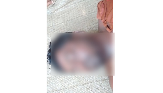 ডুমুরিয়ায় বিদ্যুৎ স্পৃষ্টে ব্যবসায়ীর মৃত্যু