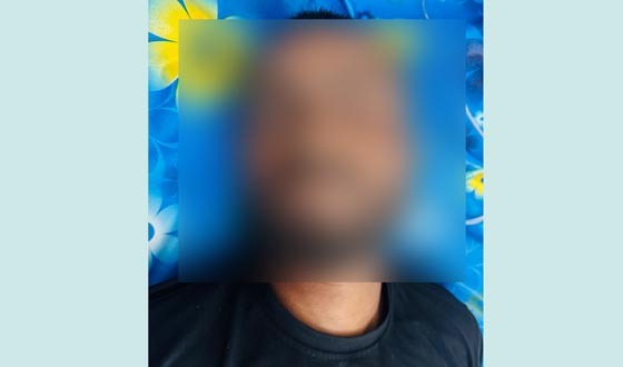 হাইমচরে বিষধর সাপের কামড়ে যুবকের মৃত্যু, হাসপাতালে উত্তেজনা