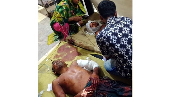 ঝিনাইদহে বাবা-ছেলেকে কুপিয়ে জখম