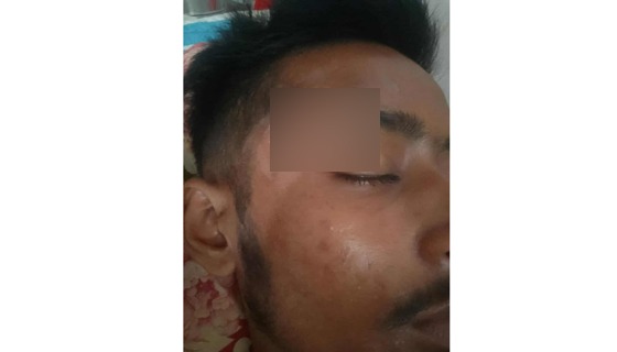 বাড়ির সীমানা নিয়ে বিরোধের জেরে  কিশোর আহত