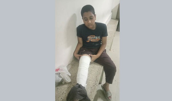 শিক্ষকের বিরুদ্ধে শিক্ষার্থীকে বেত্রাঘাতের অভিযোগ