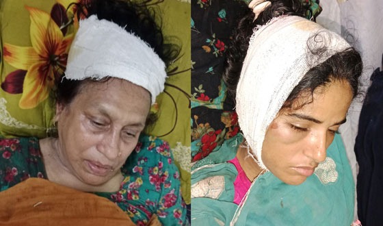 পীরগাছায় বউ-শ্বাশুরীসহ ৪ জনকে কুপিয়ে জখম, থানায় অভিযোগ