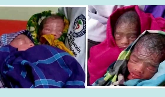 একসঙ্গে জন্ম নেওয়া জমজ ৬ শিশুর মধ্যে ৪ জনের মৃত্যু!