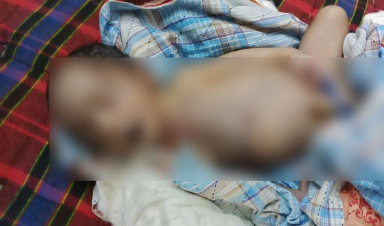 তালতলীতে সিজারের সময় নবজাতকের পেট কেটে যাওয়ায় মৃত্যু