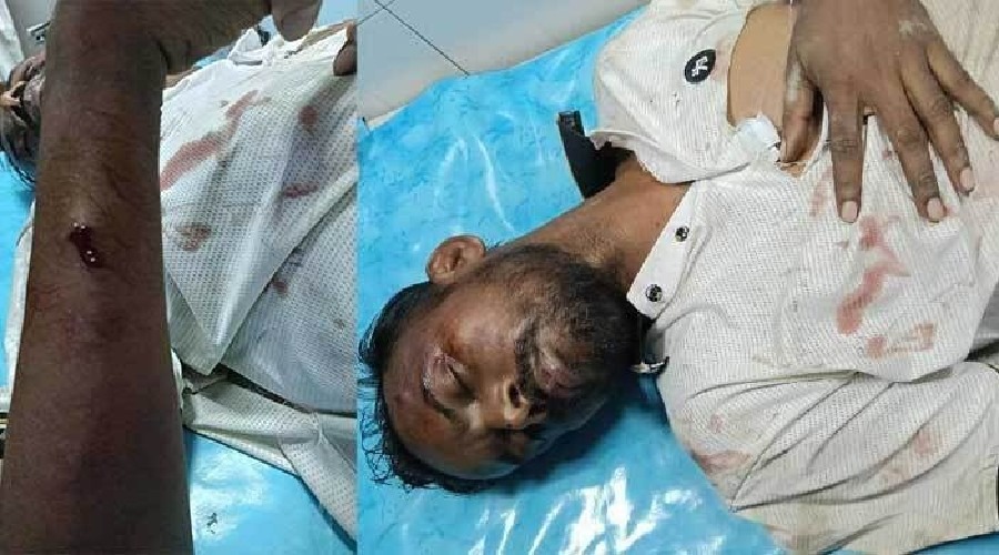 দুর্বৃত্তদের হামলায় গুরুতর আহত হিরো আলম, অবস্থা আশঙ্কাজনক