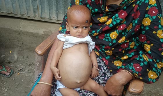 মোল্লাহাটে অসহায় শিশুর জীবন বাঁচাতে মানবিক সহায়তার আকুতি