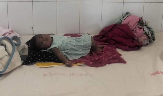 কটিয়াদী হাসপাতালে দুই দিনে ৫ শিশুর হাম সনাক্ত