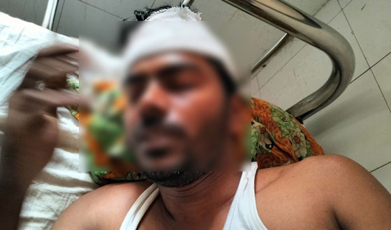 বিএনপি নেতার হামলায় যুবদল নেতা আহত