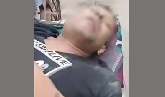 বরিশালে যুবলীগ কর্মীকে কুপিয়ে হত্যার চেষ্টা