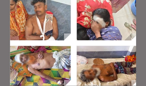 শৈলকুপায় চা বাকি না দেওয়ায় মহিলাসহ আহত ১০