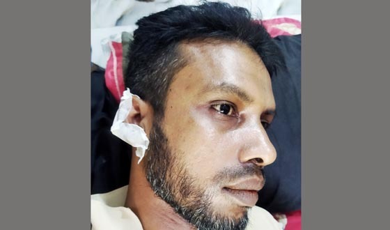 খুলনায় বিরোধের জের ধরে সৎ ভাইবোনের হামলায় আহত যুবক