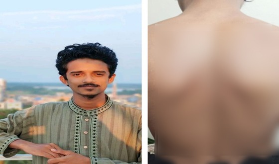 শিবির করার অপরাধে ববির কর্মচারীকে ছাত্রদলের মারধর