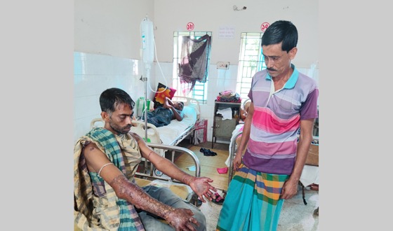কলারোয়ায় মানসিক প্রতিবন্ধীকে খুঁটিতে বেঁধে মারধর ও এসিড নিক্ষেপের অভিযোগ