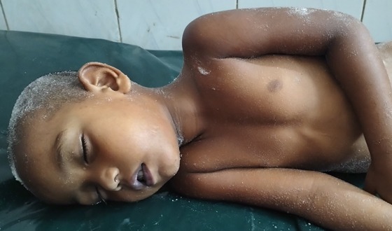 কুড়িগ্রামের উলিপুরে পুকুরে ডুবে দুই শিশুর মৃত্যু, আহত আরও এক